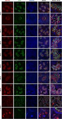 Dynamics of HSD17B3 expression in human fetal testis: implications for the role of Sertoli cells in fetal testosterone biosynthesis